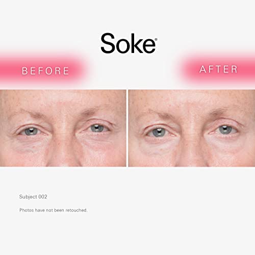 Soce Beauty Anti-Wrinkle אנטי אייג'ינג מתבהר מתחת לטיפול בסביבת עין