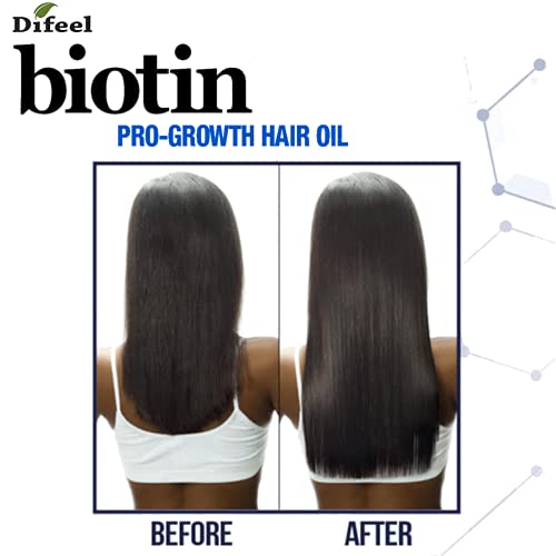 דיפיל ביוטין פרוג ' צמיחה פרימיום שיער שמן 8 עוז.