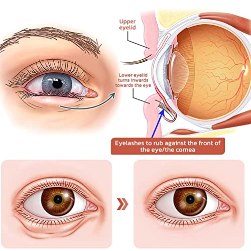 עיני קפאין מתקנות ומרימות קרם עיניים, סרום עיניים קפאין, לכל העור -1 PCS