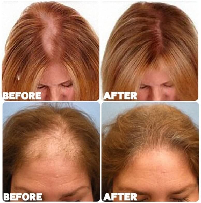 צמיחת שיער חיוני שמן שיער אובדן מוצר מהיר גדל למנוע התקרחות קרקפת טיפול יופי שיער טיפול גברים נשים