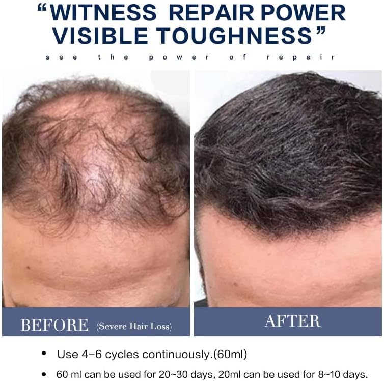 בקרת שמן שמפו שיער מזין שטיפת סרום וטיפול תיקון כפול עזר לשיער שלך להתאים יותר מתאים לגברים/נשים